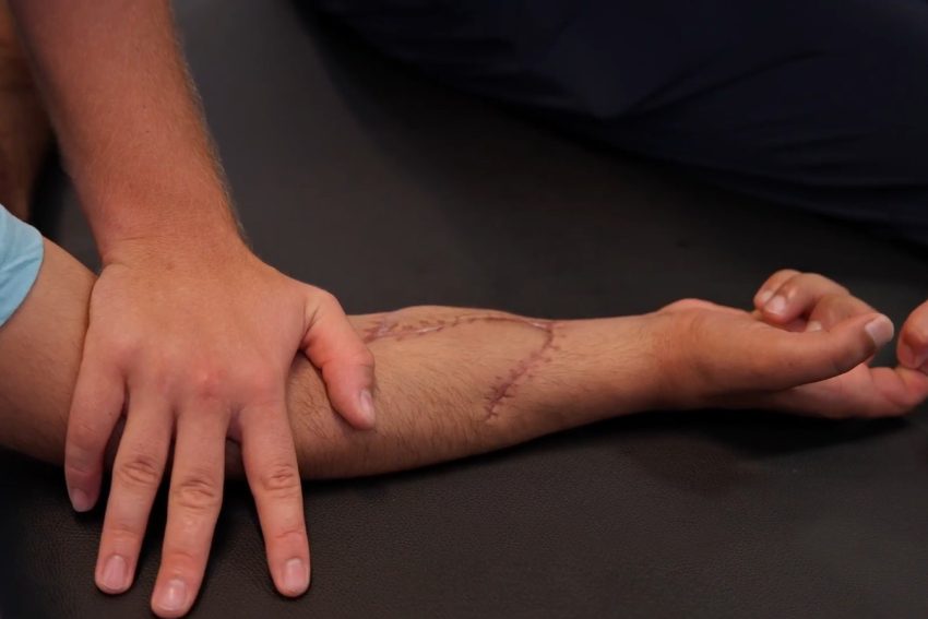 Ortopedik Rehabilitasyon